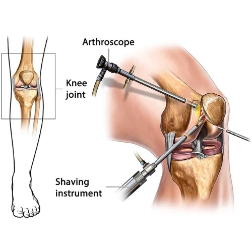 Sports Injury Management