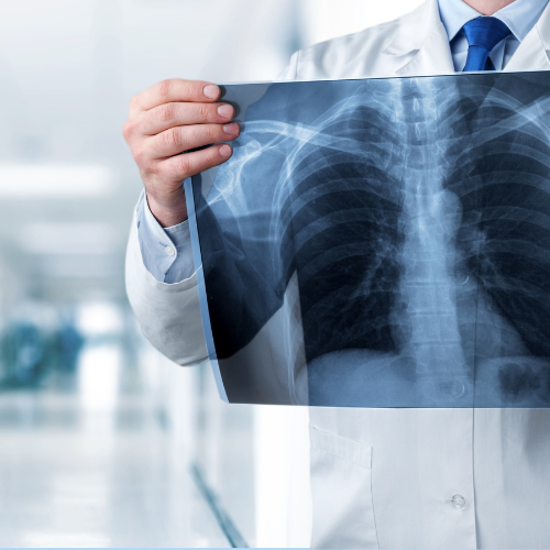 xray-services-near-Balewadi-Pune